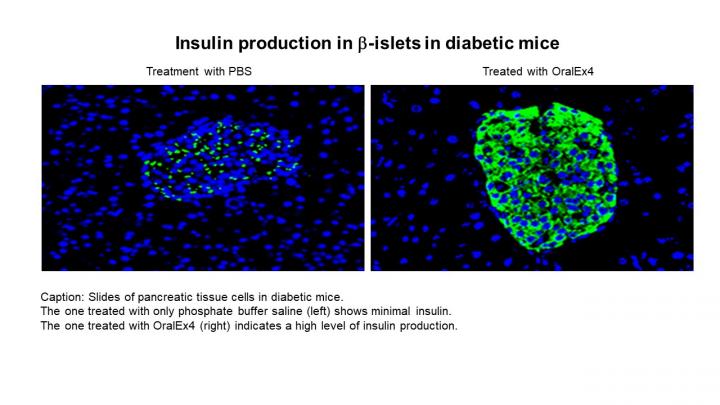 Oral formulation of diabetes drug