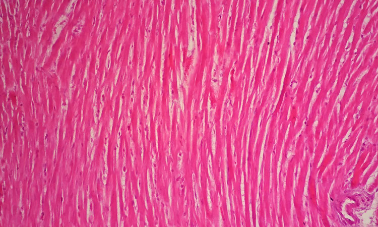 cardiac cells