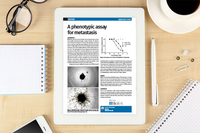 Application Note: A phenotypic assay for metastasis