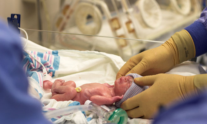 A premature newborn just after a c-section is cleaned up and prepped for the incubator shown in the background.