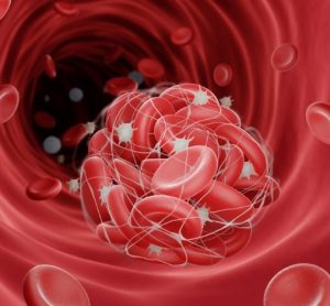 Takeda's TAK-755 trumps plasma-based therapy, trial shows