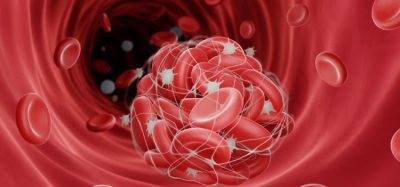 Takeda's TAK-755 trumps plasma-based therapy, trial shows