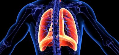 Trial-first for Roche lung cancer ALK inhibitor for ALK-positive NSCLC