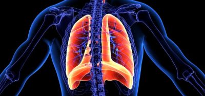 Trial-first for Roche lung cancer ALK inhibitor for ALK-positive NSCLC