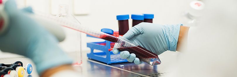 Close up of scientist pipetting blood in a laboratory