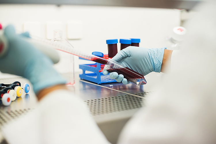 Close up of scientist pipetting blood in a laboratory