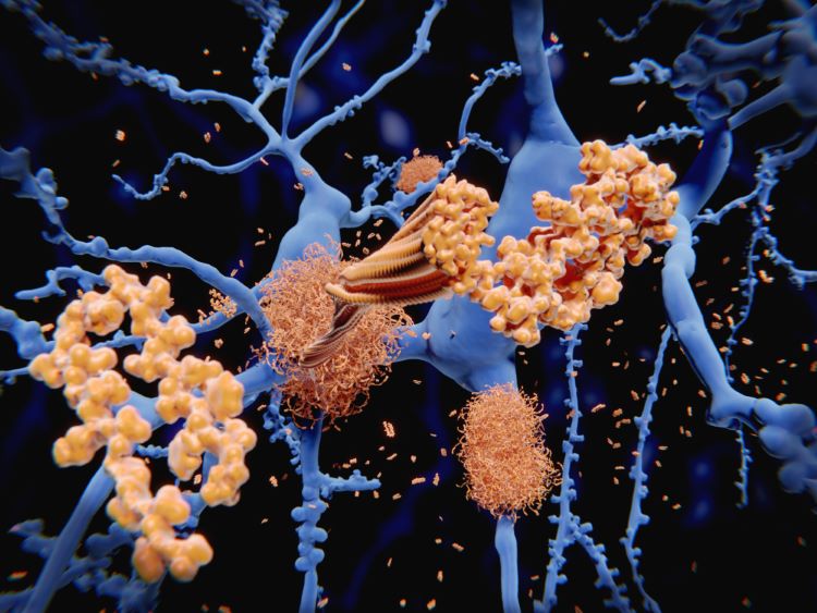 Stem-cell therapy Lomecel-B delivers potential in Alzheimer’s