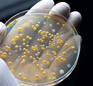 Biologist showing the results of his research against the drug resistance (bacteria colonies in white and yellow on an agar plate) in a microbiological lab
