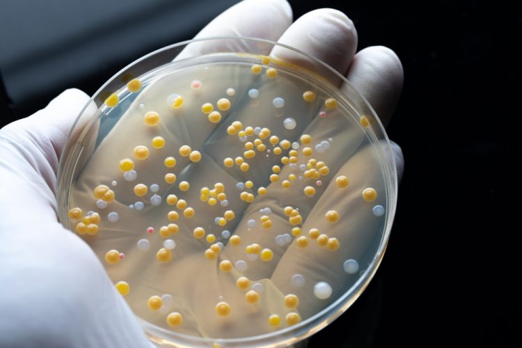 Biologist showing the results of his research against the drug resistance (bacteria colonies in white and yellow on an agar plate) in a microbiological lab