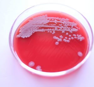 Close-up of white/grey colonies of Bacillus subtilis on blood agar plate