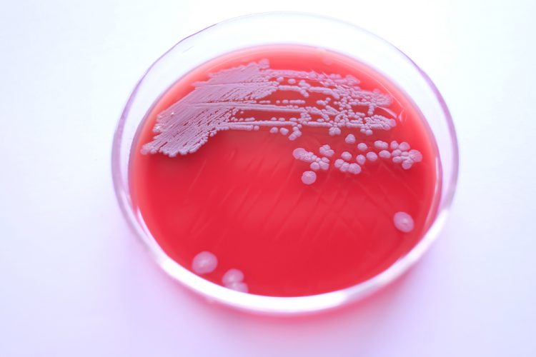 Close-up of white/grey colonies of Bacillus subtilis on blood agar plate