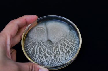 Bacillus colonies (white) growing on agar plate with black background - idea of microbial contamination