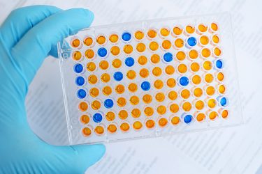 Enzyme-linked immunosorbent assay (ELISA)