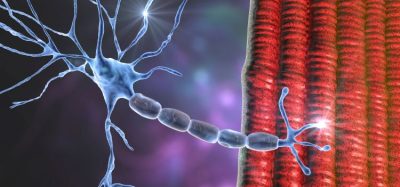 Converging knowledge and technology to transform neuromuscular disease treatment -ALS