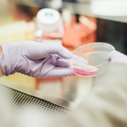 Close up of researchers hands holding a petri dish with liquid inside - idea of cell culture or cell therapy experimentation