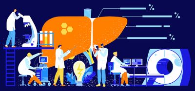 Idea of liver imaging/research - cartoon with large liver, MRI scanner and scientists performing experiments