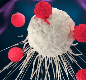 B-Cell Lymphoma