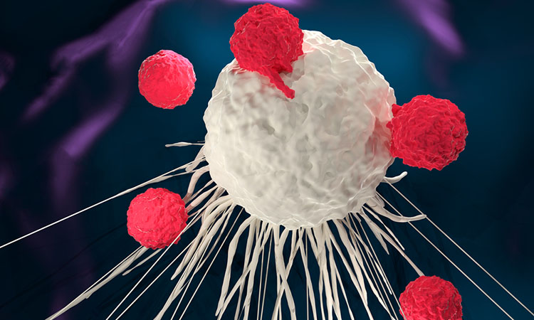 B-Cell Lymphoma