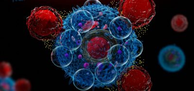 3d illustration of CAR T cells attacking cancer cells and releasing cytokines - idea of CAR T Therapy