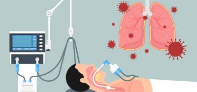 Acute respiratory distress syndrome (ARDS) concept - cartoon of patient in hospital bed intubated and on breathing machine due to respiratory failure/distress