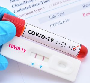 COVID-19 antibody test