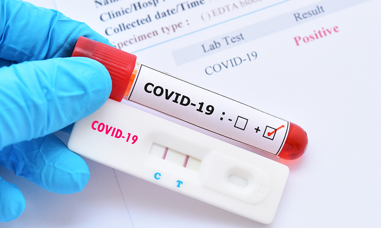 COVID-19 antibody test