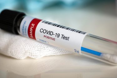 coronavirus swab test with positive result