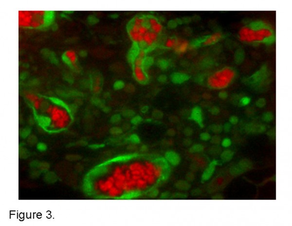 Figure 3 Multispectral tissue imaging. A spectrally unmixed tumour tissue slice from a subcutaneous implantation of unlabelled MC38 adenocarcinoma cells transplanted into a GFP transgenic mouse. Haemoglobin containing red blood cells (red) and GFP labelled host inflammatory and endothelial cells (green) unmixed with a Nuance multispectral microscope and associated software