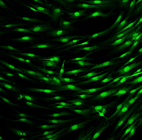 Chemometrics: Implementing multivariate data analysis to monitor mammalian cell culture processes