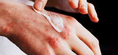 Hoth Therapeutics HT-001 cancer