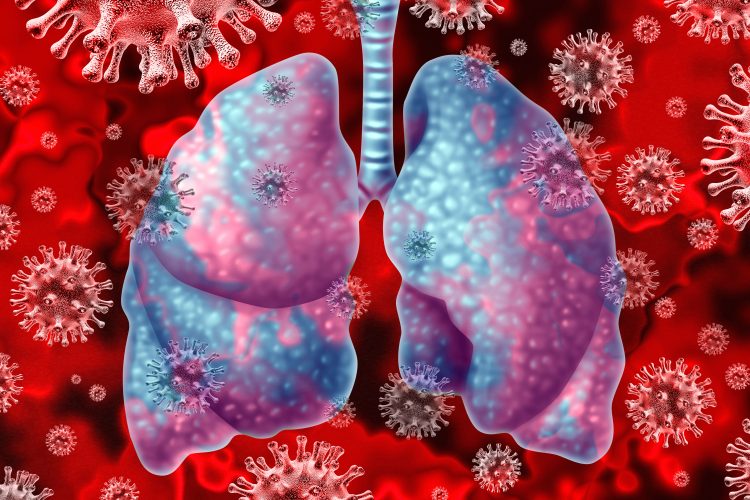 coronavirus particles in grey surrounding lungs