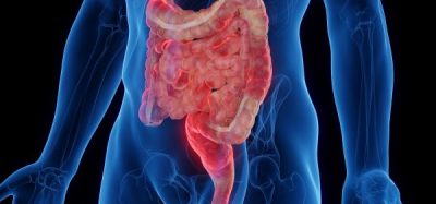 NICE recommends Rinvoq® for Crohn’s