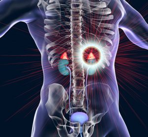 3D rendering of a human body with the adrenal glands above the kidneys highlighted - idea of over production of adrenaline/cortisol or Cushing's disease