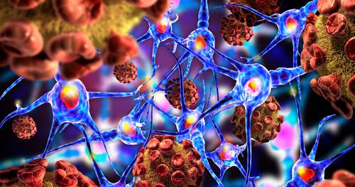 FDA Sarepta ELEVIDYS