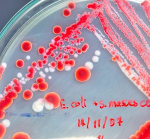 red E coli colony in petri dish