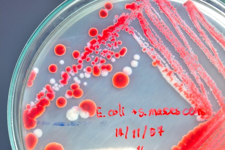 red E coli colony in petri dish