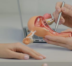 Gynecologist doctor consulting patient using uterus anatomy model
