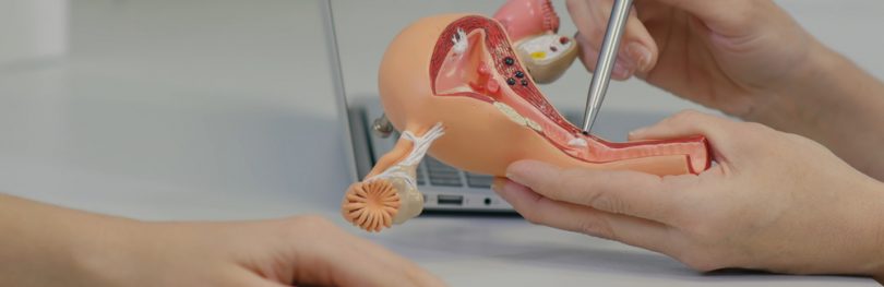 Gynecologist doctor consulting patient using uterus anatomy model