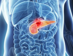 Evofosfamide-pancreatic-cancer