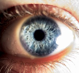 AAO 2023: intravitreal treatment shows benefit in geographic atrophy (GA)