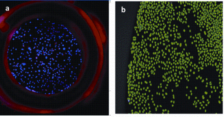 Figure 6: Image acquisition and Analysis of cell based assays performed in micro well array format (a) Showing X4 image of cells labelled with the DNA dye Hoechst in a well of a micro-array device (b) Showing a 10X image of Hoechst stained nuclei which have been detected and masked (green) by a simple High content image analysis algorithm for determining nuclear count per sample