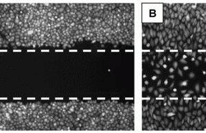 Figure 1 Principle of 2D cell migration assays. (A) A confluent monolayer of cells is mechanically wounded (‘scratch assay’), usually with a sterile pipette tip, leaving two wound edges (dashed lines) separated by a void. Cells at the leading edges quickly assume a polarised morphology and form broad lamellae pointing into the direction of the void. Over time, cells migrate into the void and, eventually, completely close the wound (B). Cell migration is qualitatively assessed by visual inspection and can be quantitated by measuring gap width or by enumeration of cells populating the wound. Images show T98G human glioblastoma cells immediately after wounding (A) or after 24 hours of migration (B). Distance between lines is one millimetre