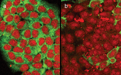 Figure 1: RNAi silencing of a neurodegeneration disease gene (in green) in nervous system stem cells in b, with control treated cells in a.