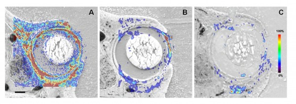FIGURE 3High spatial resolution MALDI-MS image showing the distribution of an orally-dosed compound (overlaid over the optical image) in rat ocular tissue at one hour (A) three hours (B) and six hours (C) postdose. In this instance, the compound was observed at the highest concentrations one hour post-dose and only low levels were observed six hours after dosing. Scale bar = 1 mm