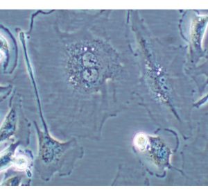 Figure 1 Cell undergoing senescence. Cell showing characteristics of cellular senescence: binucleated and flat and enlarged morphology