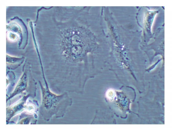 Figure 1 Cell undergoing senescence. Cell showing characteristics of cellular senescence: binucleated and flat and enlarged morphology