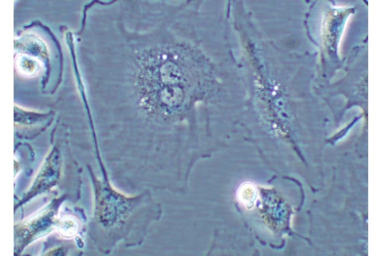 Figure 1 Cell undergoing senescence. Cell showing characteristics of cellular senescence: binucleated and flat and enlarged morphology