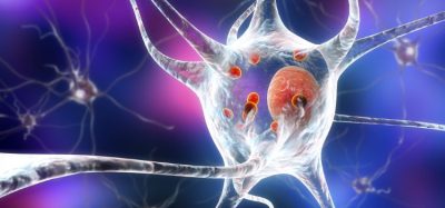 NICE recommends first Parkinson’s treatment - Foslevodopa–foscarbidopa