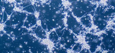 Glioblastoma cells