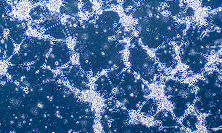 Glioblastoma cells